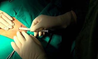 Bolu’da, madde bağımlıları deri altına koyulan çiple tedavi oluyor